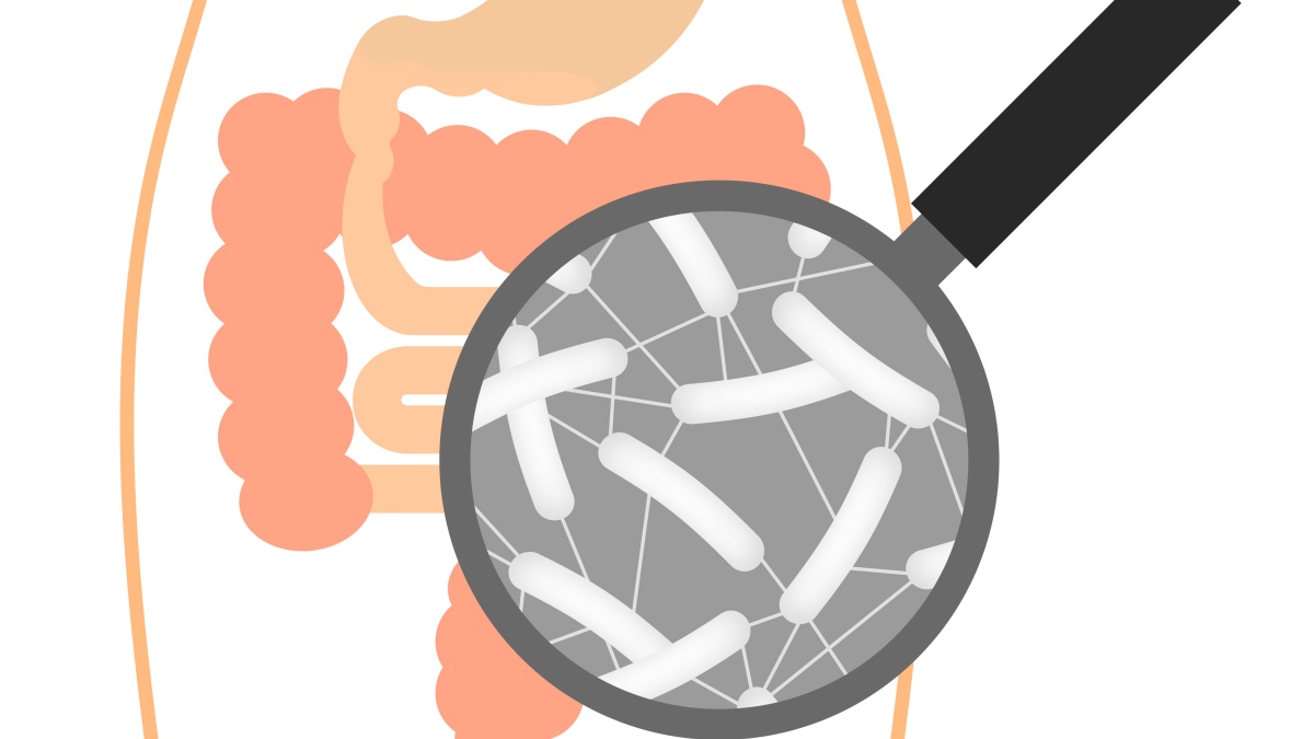 Malattie infiammatorie croniche intestinali