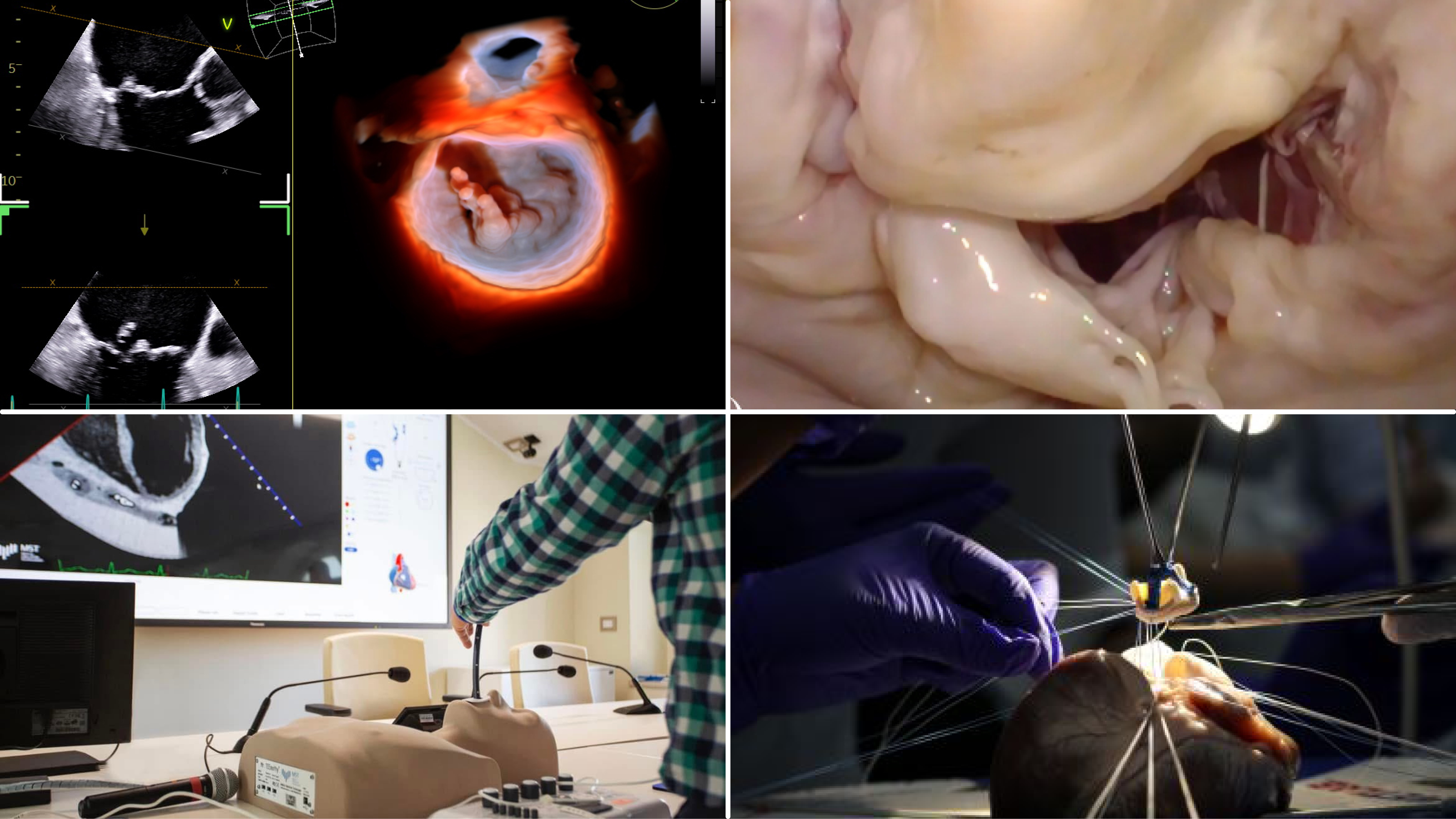 Echo-Surgery Lab – Rome