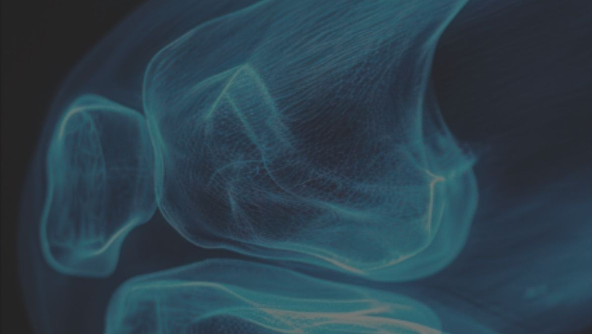 La chirurgia robotica nella artroprotesi di ginocchio