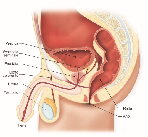 tumore prostata avanzato sintomi
